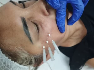 Clinica de estética em Ibirité-l