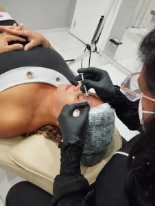 botox-harmonizacao-facial-ibirite