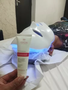 peeling-quimico-rejuvenescimento-ibirite