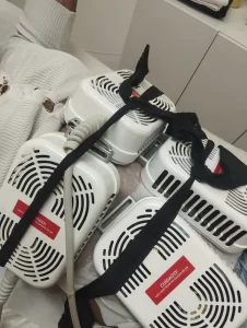 radiofrequencia-facial-flacidez-ibirite-2